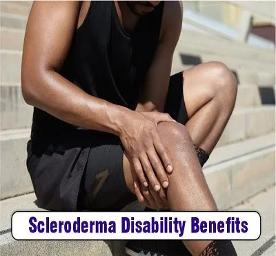 Disability Benefits for Scleroderma